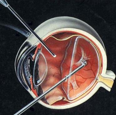 QQ截图20170208172645.jpg QQ截图20170208172645.jpg