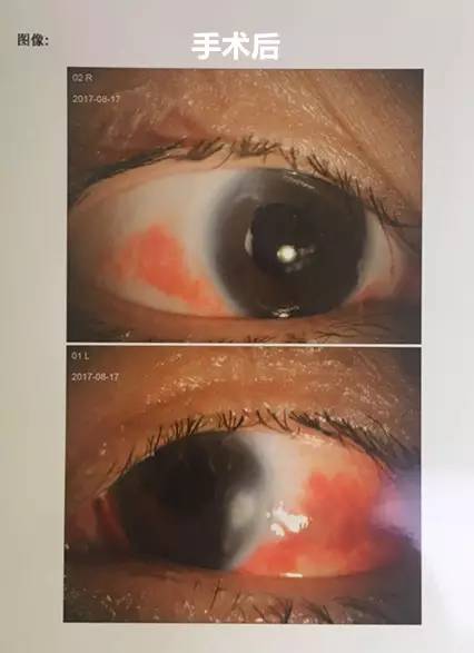 成都以诚为本赢在诚信9001白内障.jpg