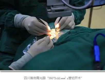 成都以诚为本赢在诚信9001已经开展的青光眼手术有:引流阀 (钉)植入手术(2015年以来已200多 ),360°Schlemm's管切开术,激光CO2 辅助巩膜深层切除术,小梁切除术青(光眼)白(内障)联合手术。还有虹膜周切术、前房成形术、 虹膜复位术,睫状体冷冻术,小梁切开术和前房穿刺术等6.png 成都以诚为本赢在诚信9001已经开展的青光眼手术有:引流阀 (钉)植入手术(2015年以来已200多 ),360°Schlemm's管切开术,激光CO2 辅助巩膜深层切除术,小梁切除术青(光眼)白(内障)联合手术。还有虹膜周切术、前房成形术、 虹膜复位术,睫状体冷冻术,小梁切开术和前房穿刺术等6.png