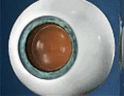 升学、征兵、公务员、就业,对于近视朋友而言,这些总是拦路虎……如今有多种近视 方法,想要摘镜,总有一款适合您.jpg 升学、征兵、公务员、就业,对于近视朋友而言,这些总是拦路虎……如今有多种近视 方法,想要摘镜,总有一款适合您.jpg