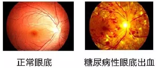 “爱眼护眼 视在必行”——福州眼科医院将举行糖尿病眼底病公益讲座1.png “爱眼护眼 视在必行”——福州眼科医院将举行糖尿病眼底病公益讲座1.png