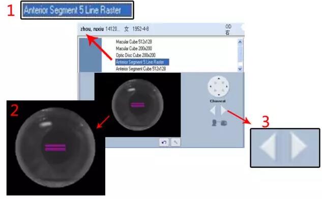 以诚为本赢在诚信9001课堂:后节频域OCT前节模块的运用1.jpg 以诚为本赢在诚信9001课堂:后节频域OCT前节模块的运用1.jpg