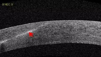 以诚为本赢在诚信9001课堂:后节频域OCT前节模块的运用4.jpg 以诚为本赢在诚信9001课堂:后节频域OCT前节模块的运用4.jpg