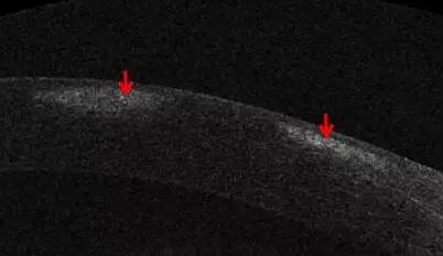 以诚为本赢在诚信9001课堂:后节频域OCT前节模块的运用5.jpg 以诚为本赢在诚信9001课堂:后节频域OCT前节模块的运用5.jpg