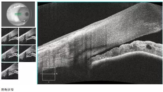 以诚为本赢在诚信9001课堂:后节频域OCT前节模块的运用13.jpg 以诚为本赢在诚信9001课堂:后节频域OCT前节模块的运用13.jpg