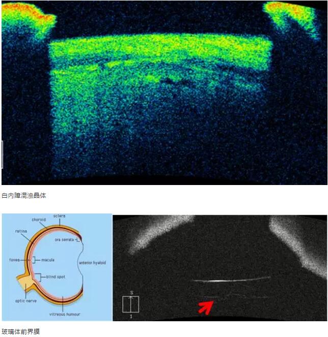 以诚为本赢在诚信9001课堂:后节频域OCT前节模块的运用14.jpg 以诚为本赢在诚信9001课堂:后节频域OCT前节模块的运用14.jpg