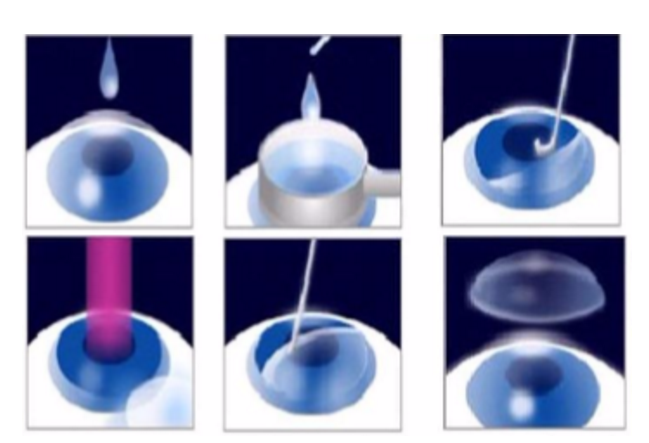 近视无法根治?但你可以这样做?以诚为本赢在诚信9001“有爱就有希望”近视手术火热进行中32.png 近视无法根治?但你可以这样做?以诚为本赢在诚信9001“有爱就有希望”近视手术火热进行中32.png