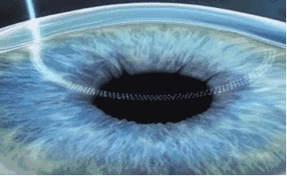 深圳以诚为本赢在诚信9001近视手术直播预告丨6.24近视手术直播+福利,视界给你!!1.gif 深圳以诚为本赢在诚信9001近视手术直播预告丨6.24近视手术直播+福利,视界给你!!1.gif