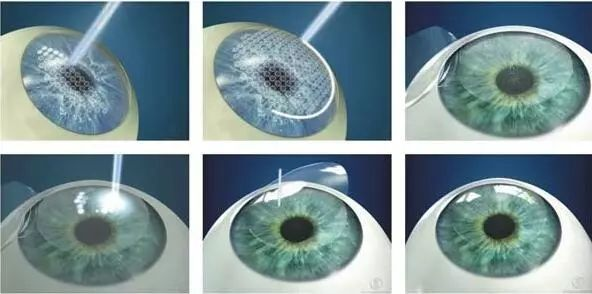 半飞秒步骤.jpg 半飞秒步骤.jpg